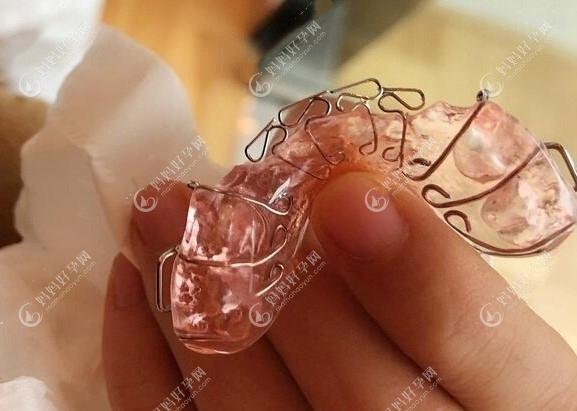 儿童正畸哪儿做的好-图3