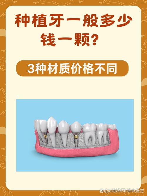 江阴种牙优惠-图1