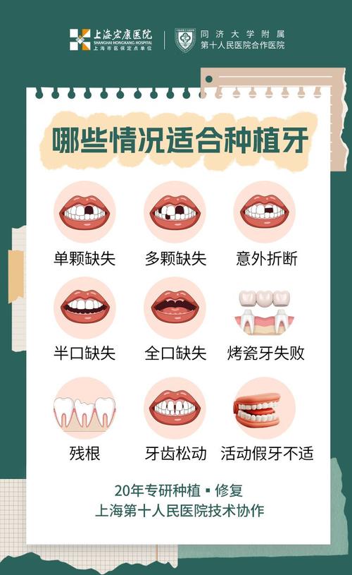 种牙可以选择-图3