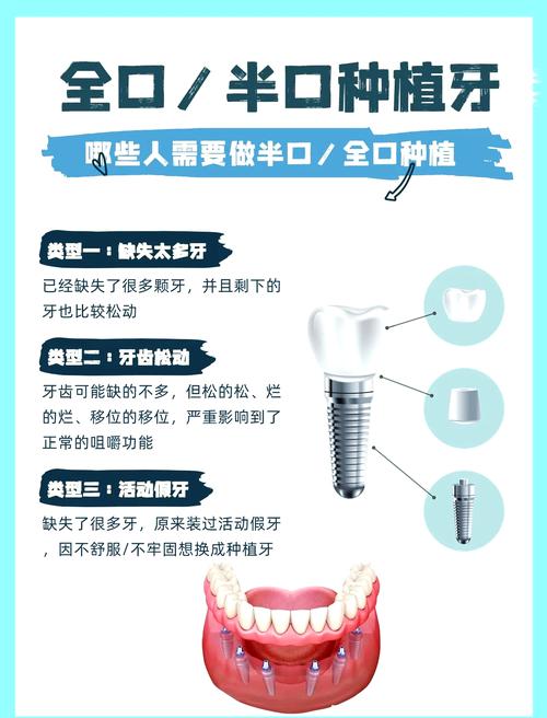 种牙可以选择-图2