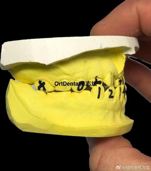 正畸FR是什么意思-图2