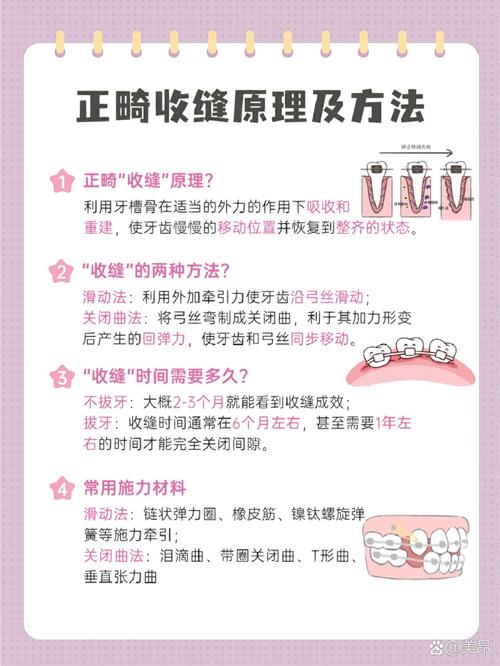 正畸滑动内收的原理-图1 正畸滑动内收的原理-图1