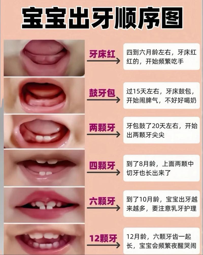 儿童种牙有必要吗？家长必知的适应症、时机及重要性-图2