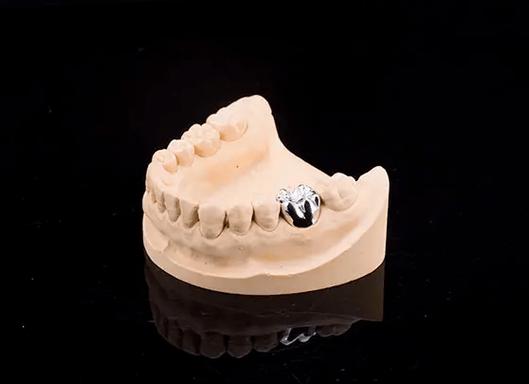 种牙金属牙冠-图3