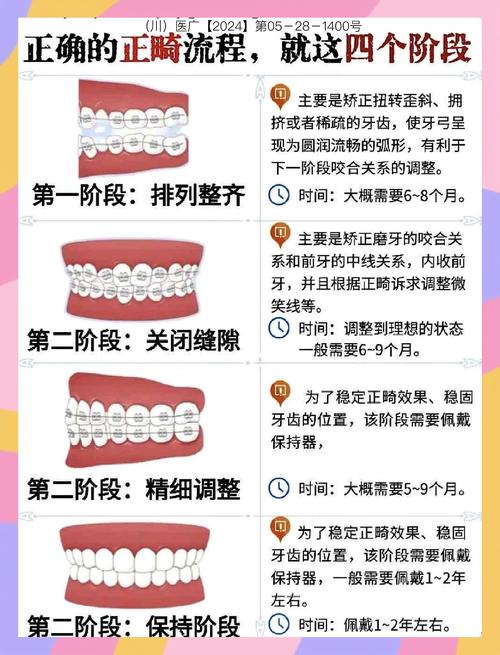 正畸期间,牙列排齐的具体步骤和注意事项是什么?-图1 正畸期间,牙列排齐的具体步骤和注意事项是什么?-图1