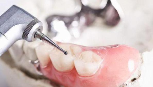 科瓦齿科种牙效果如何？安全靠谱吗？-图2