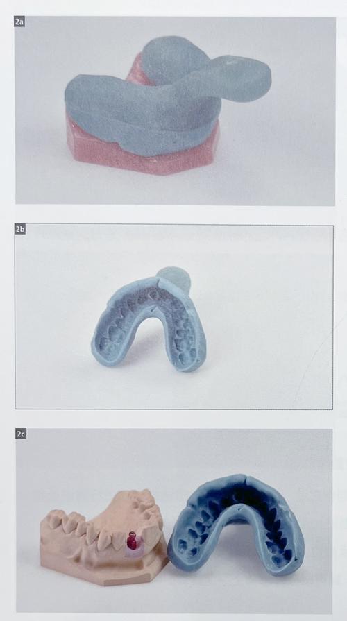 种牙时转移杆如何确保种植精准？-图2