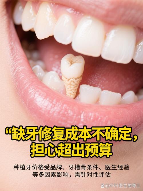 长沙种牙到底好不好？效果、价格和医院选择靠谱吗？-图3
