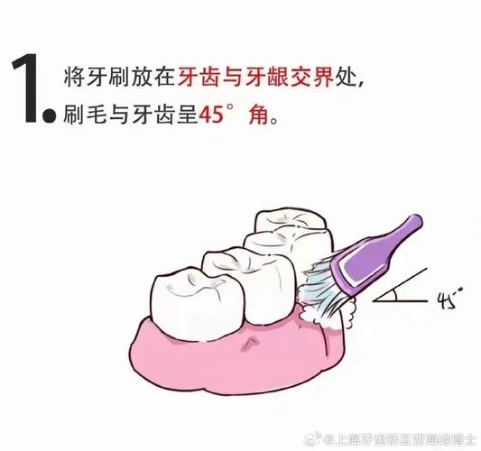 正畸刷牙是横着刷吗-图3