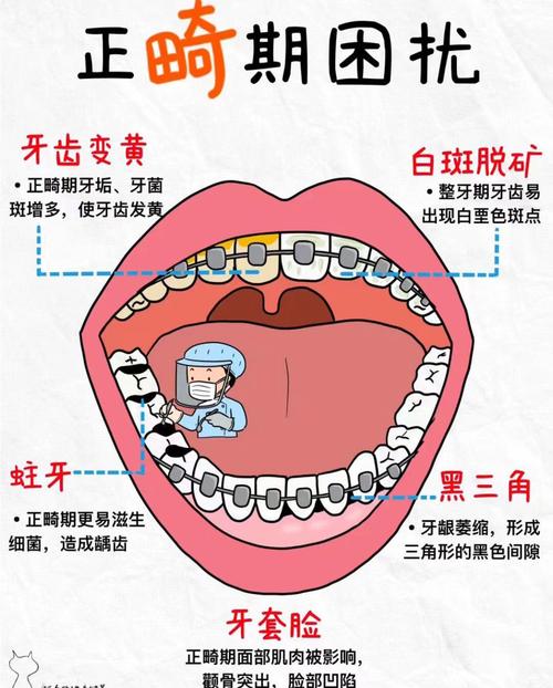 正畸刷牙是横着刷吗-图1