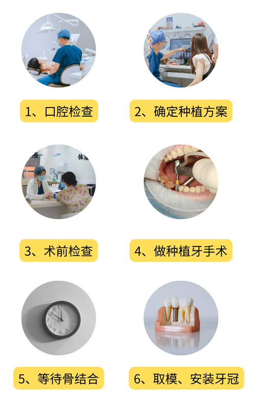 种牙前期准备-图1