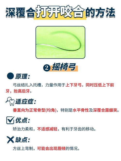 正畸橡皮链怎么用？正确使用方法与步骤解析-图2