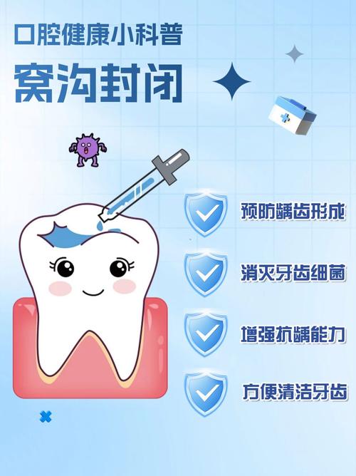 口腔正畸前窝沟封闭-图1