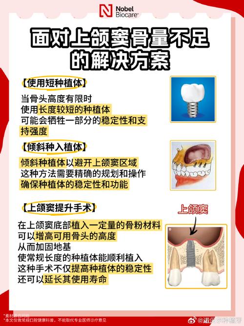 种牙 上颌窦-图3