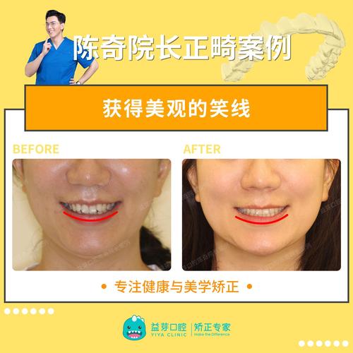 隐适美正畸医生登录入口及流程是什么？-图2