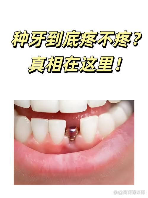 种牙 疼不疼-图2