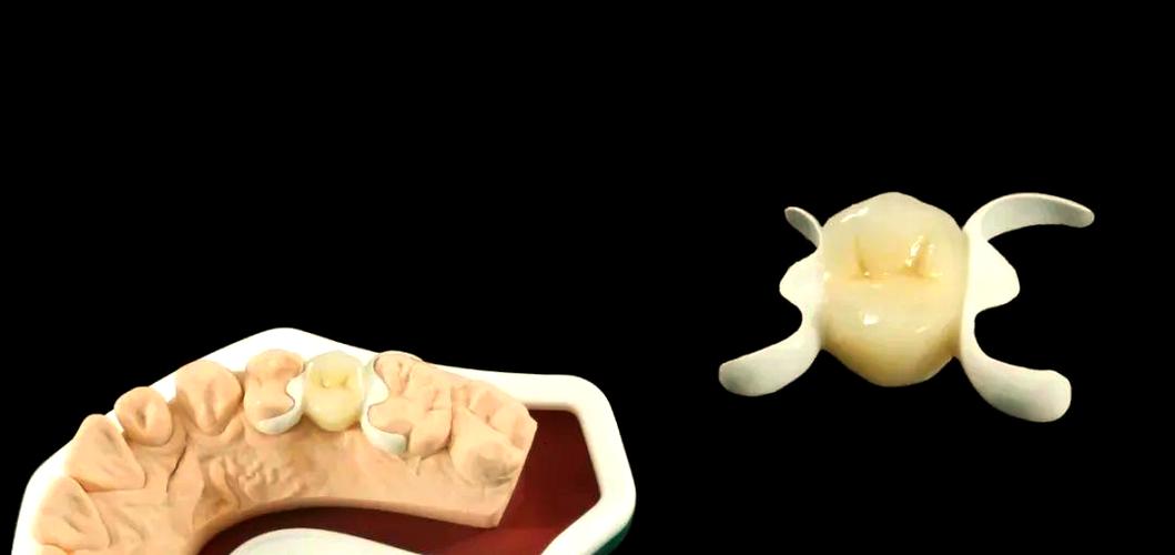 正畸常用的粘接技术-图3