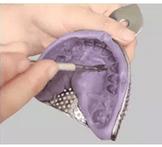 正畸硅橡胶取模方法-图3