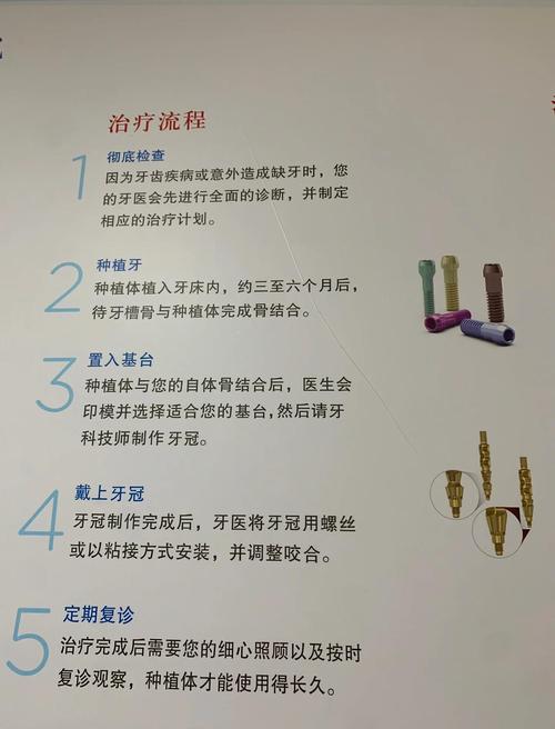 磨牙种牙方案-图1 磨牙种牙方案-图1