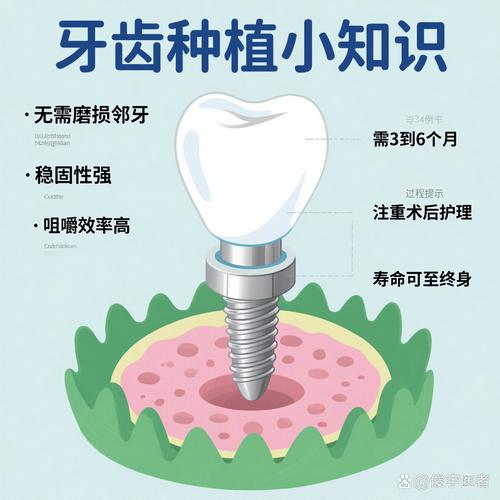 磨牙种牙方案-图3 磨牙种牙方案-图3