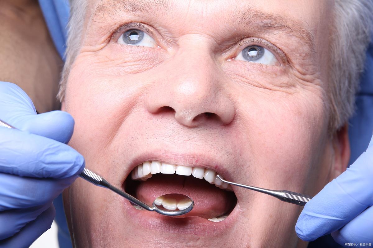 80岁可种牙-图2 80岁可种牙-图2