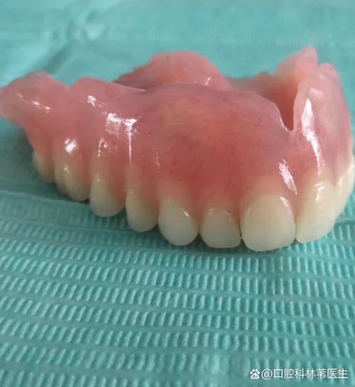 80岁可种牙-图3 80岁可种牙-图3