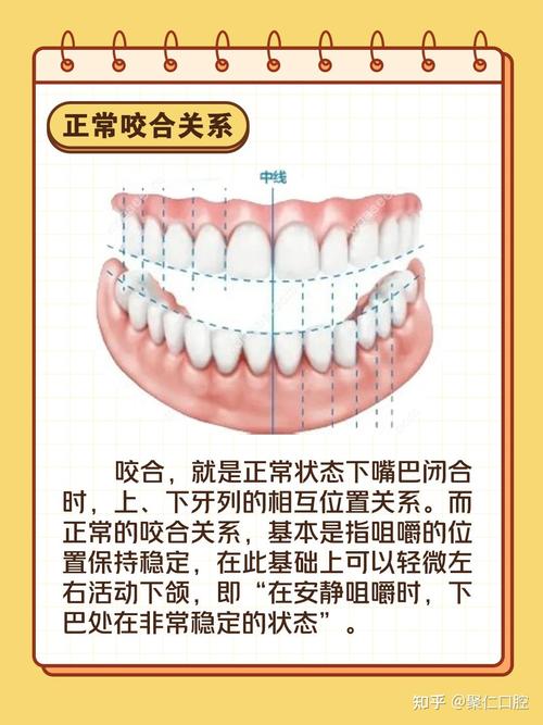 正畸夹面管怎么区分不同种类？-图3