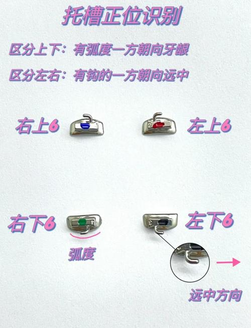 正畸夹面管怎么区分不同种类？-图1