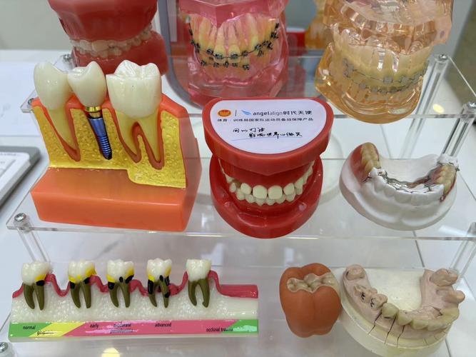 深圳种牙活动有哪些优惠？如何报名参与有保障吗？-图1