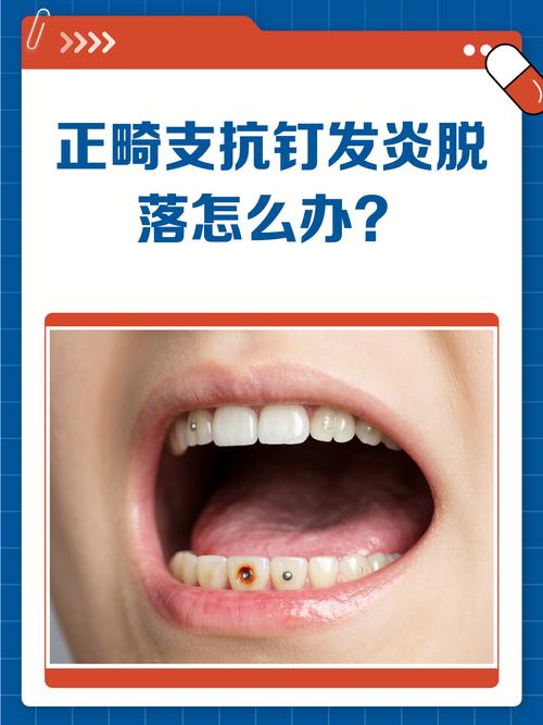 正畸时支抗钉发炎了-图1