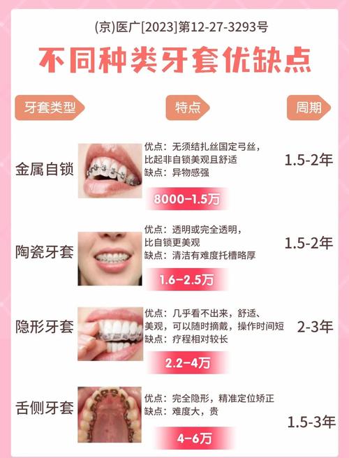 牙套有多少种-图1
