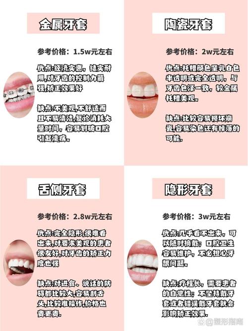 牙套有多少种-图3