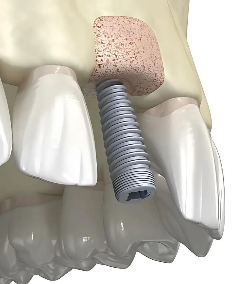 种牙有神经吗-图2
