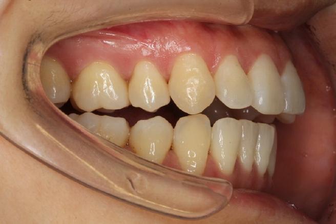 关节有问题能正畸么-图1