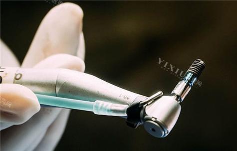 种牙美国植体-图1