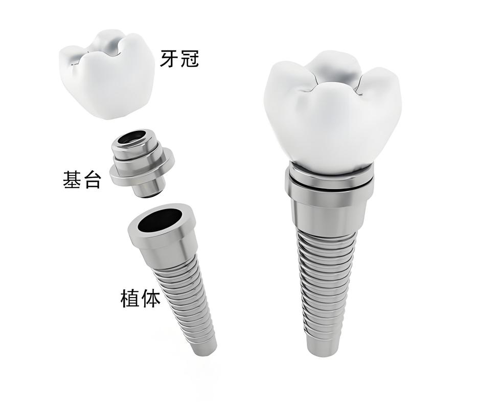 种牙安装基台-图2 种牙安装基台-图2