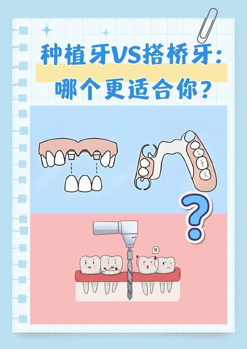 种牙还是正畸-图1