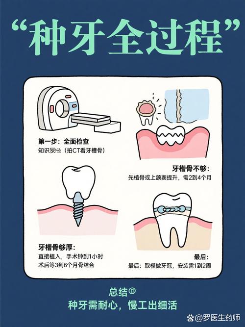种牙维持多久-图3