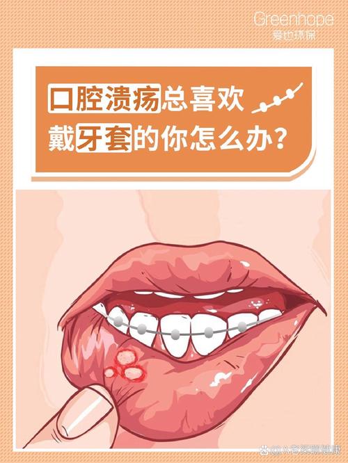 牙齿正畸期间口腔溃疡频发，该如何有效应对？-图3