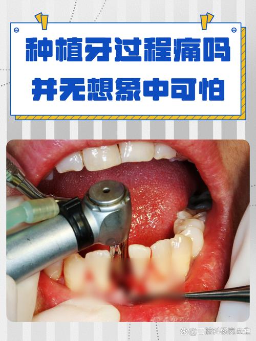 种牙手术疼吗？过程和术后疼痛程度到底如何？-图2