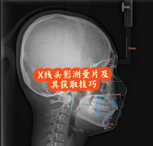 正畸头影测量图下载资源哪里找？-图3