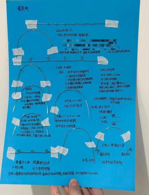 零基础学习口腔正畸-图2