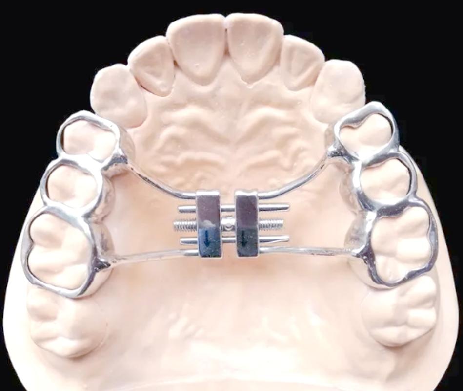 牙正畸结扎丝成型器-图2