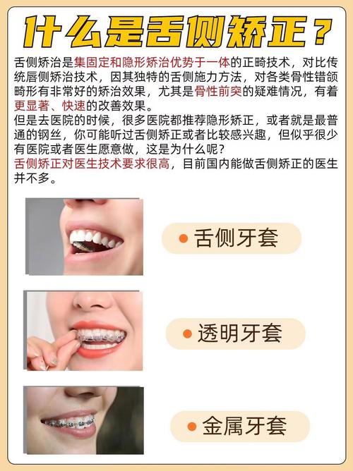 舌侧隐形微正畸技术-图3