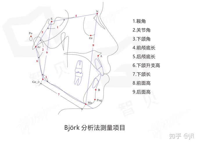 正畸头侧测量数据图的核心数据如何指导正畸方案？-图1