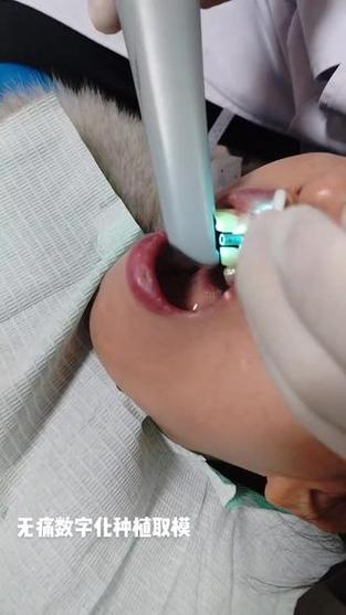 allon4种植牙取模-图2