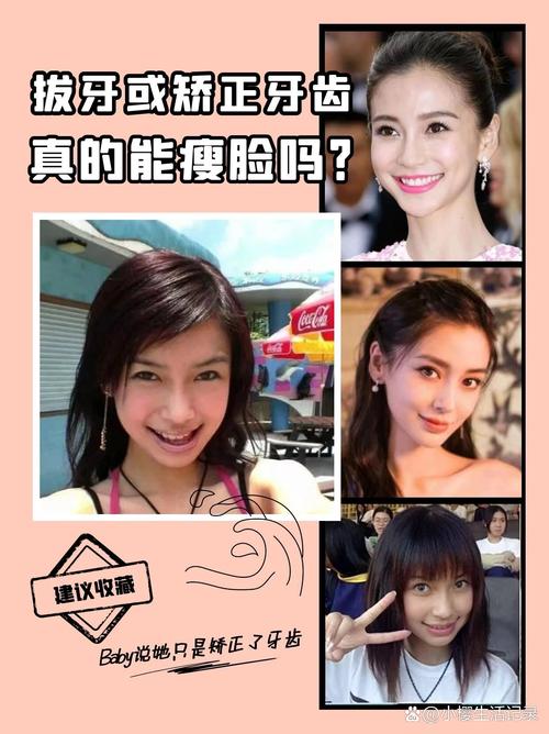 明星们正畸拔牙了吗-图2 明星们正畸拔牙了吗-图2