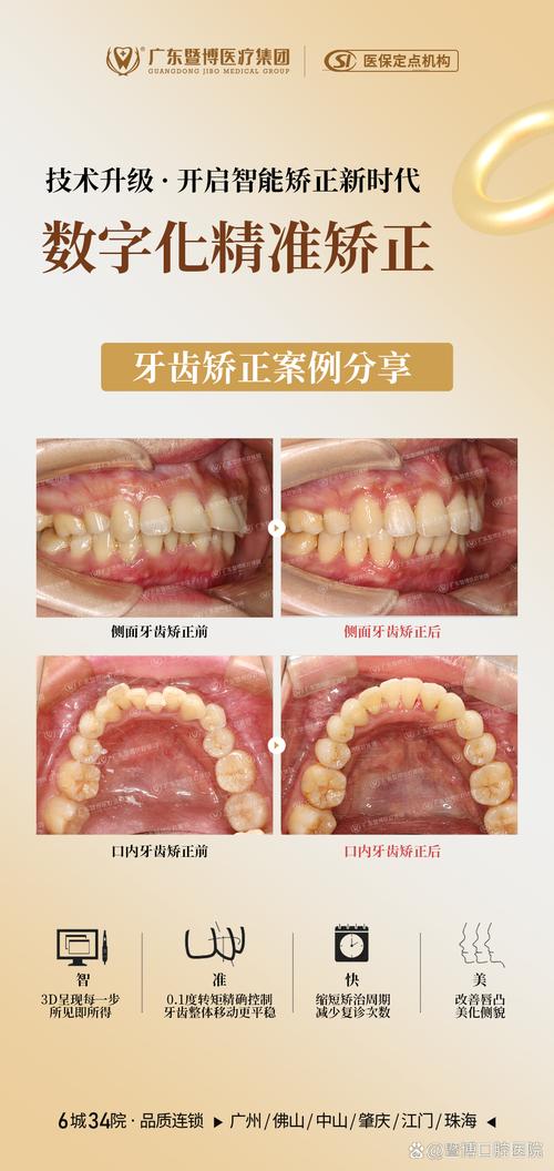 中山牙齿正畸哪家好?选机构该看重口碑、技术还是效果?-图2 中山牙齿正畸哪家好?选机构该看重口碑、技术还是效果?-图2