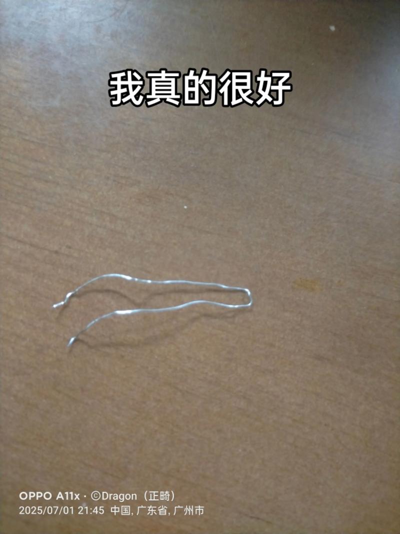 正畸结扎丝对折结扎-图2