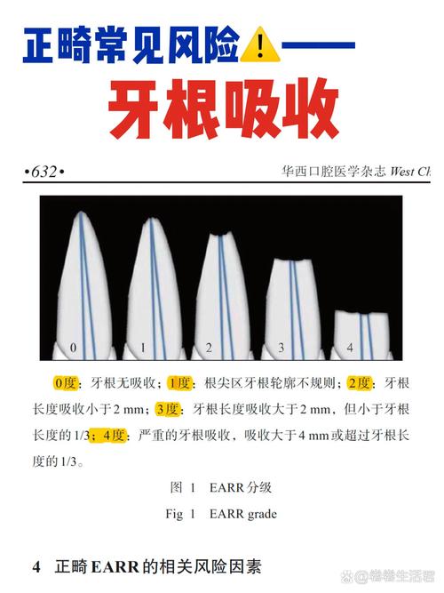 牙根吸收患者能进行正畸治疗吗？-图1